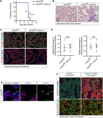 Endothelial SARS-CoV-2 infection is not the underlying cause of COVID-19-associated vascular pathology in mice